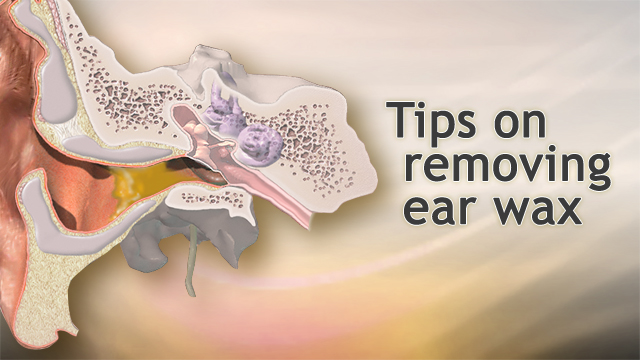 Hie Multimedia Tips On Removing Ear Wax