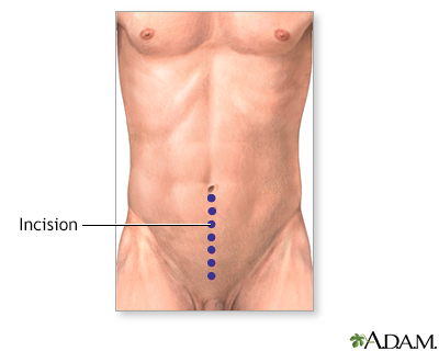 Top 3 garcinia cambogia image 1