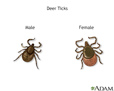 can a dog die from a tick bite