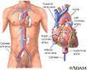 Cardiac catheterization