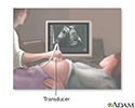 Ultrasound in pregnancy