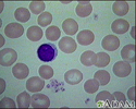 Red blood cells - normal