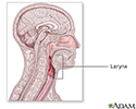 Laryngoscopy - series