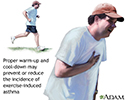 Exercise-induced asthma