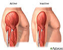 Active vs. inactive muscle