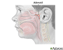 Adenoid removal - Series