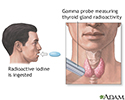 Thyroid uptake test