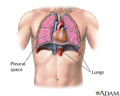 Pneumothorax - series - normal anatomy