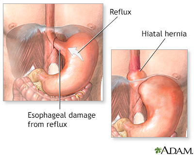 Hard Pain Sex