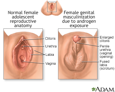 Developmental disorders of the vagina and vulva