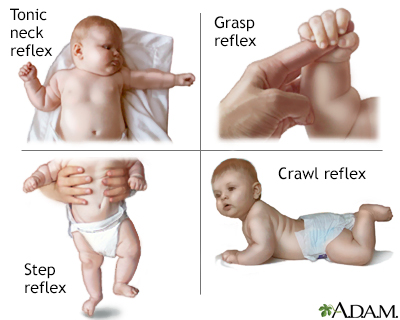 Infantile primitive reflexes.