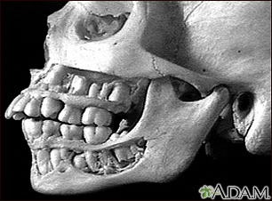 Teeth, adult - in the skull
