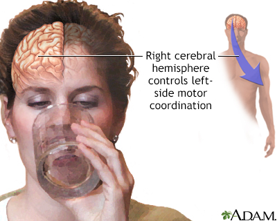 Right cerebral hemisphere - function