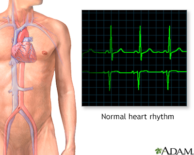 Normal heart rhythm