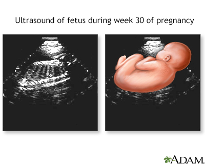 30 week ultrasound