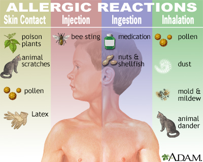 effects latex Cause allergies of