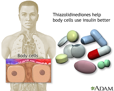 Thiazolidinediones