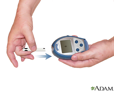 glucose test machine without strips