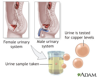 Copper urine test