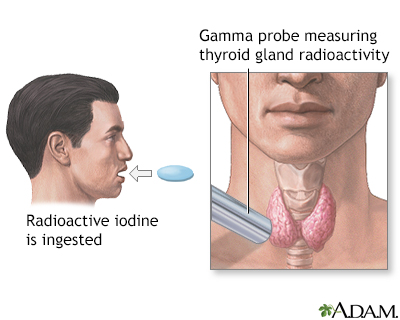 Thyroid uptake test