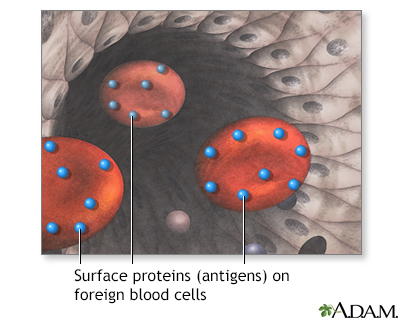 Surface proteins causing rejection
