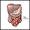 Meckel's diverticulectomy - normal anatomy