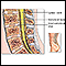 Lumbar spinal surgery - Series