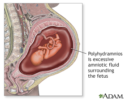 amniotic sac diagram