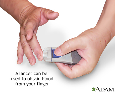 can you check your blood sugar without pricking your finger